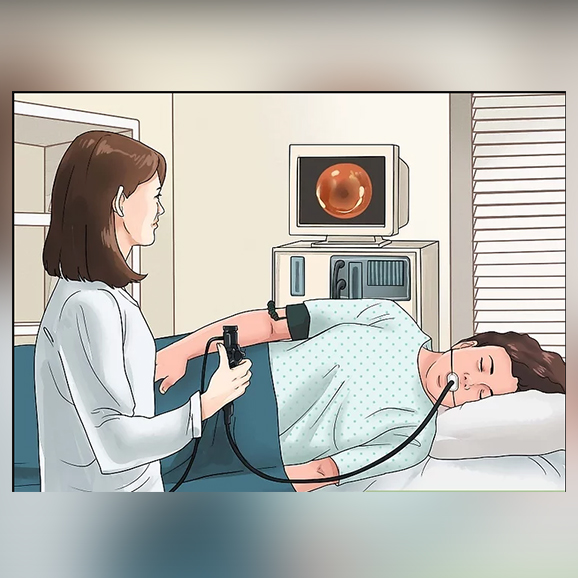 Visual Representation of Endoscopy Procedure