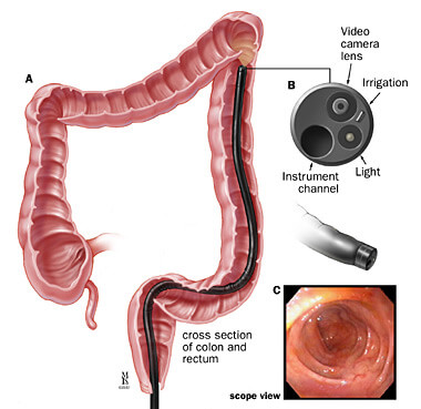 Dr. Chirag performing sigmoidoscopy procedure